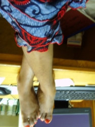 my Legs