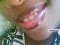 those lips