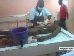 Autopsy, test after death 