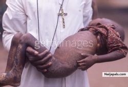 A child bearing burn-marks in the arms of a priest during the conflict in Biafra, a secessionist state in southern Nigeria, circa 1970.