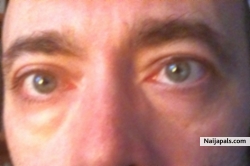 eyes