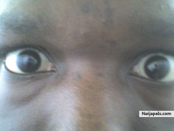 two eyes