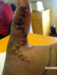 this is my finger