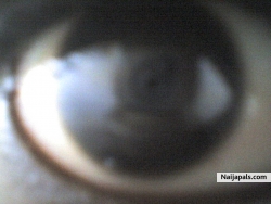 BIG eyeball
