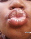 KISSES