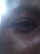 eye only