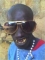 fyn boy no pimple