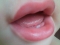 Kiss Kiss