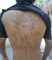 MY BACK TA2 