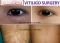 Vitiligo treatment in delhi