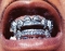 Ice Grillz