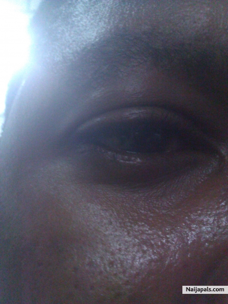 eye only - click for next photo