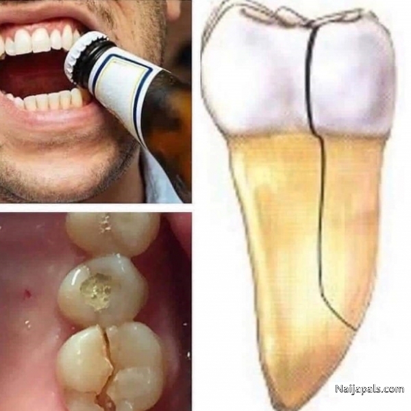 stop using your teeth as opener - click for next photo