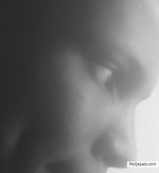 Dimple - click for next photo