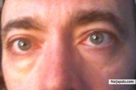 eyes - click for next photo