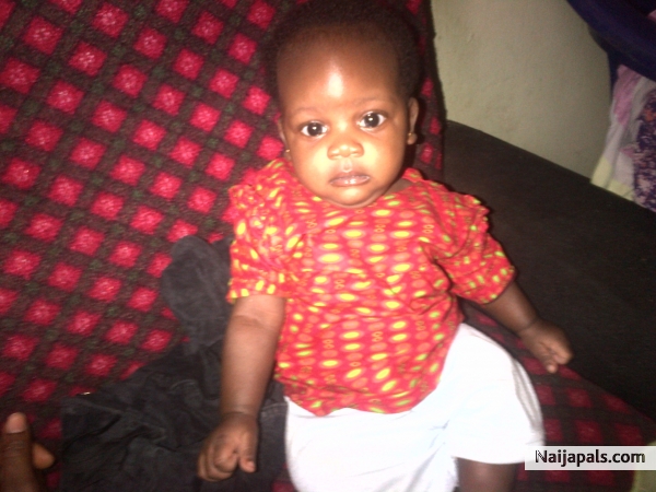 my booboo - click for next photo