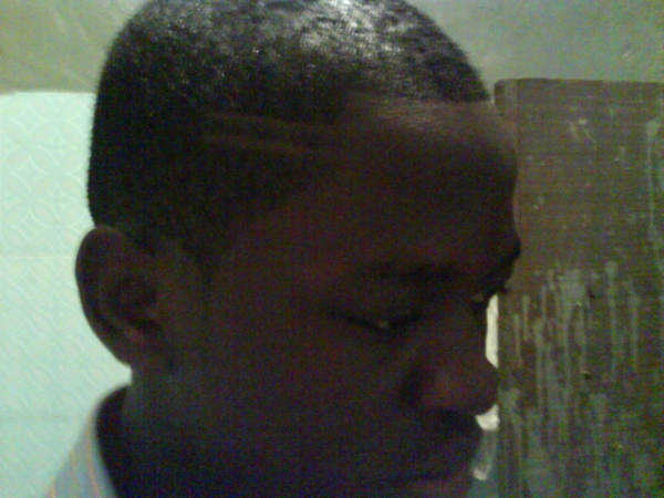 can ya see ma cut - click for next photo