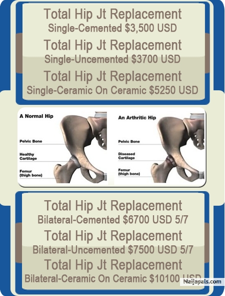 Hip Replacement Surgery in Pune, India - click for next photo