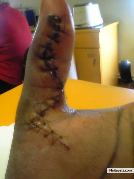 this is my finger - click for next photo