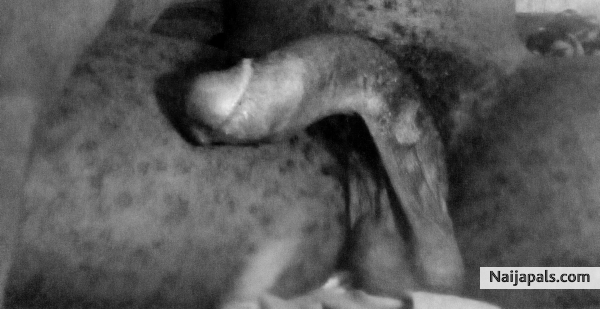  - click for next photo
