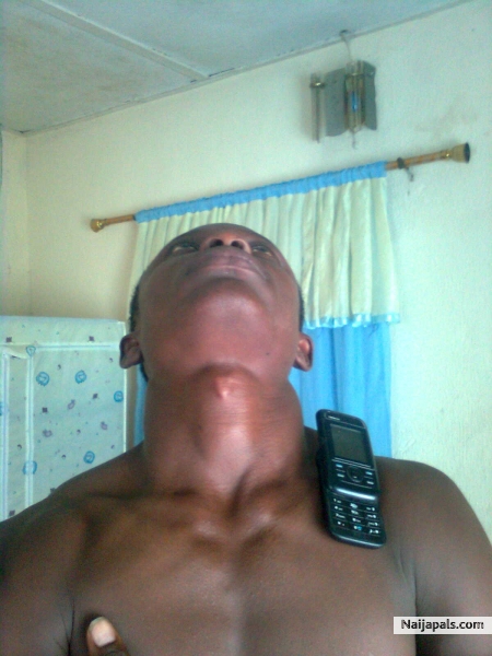 let the black skin be seen - click for next photo