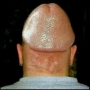 HENROMAN